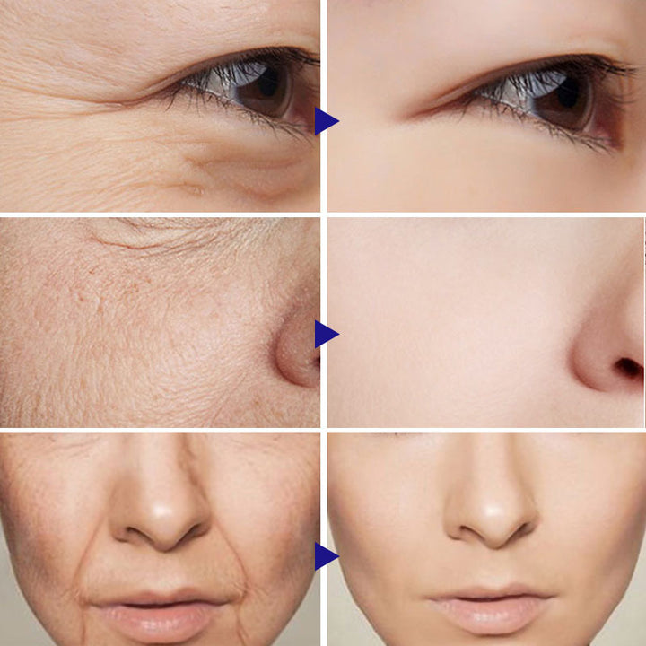 Pure vitamin C facial serum