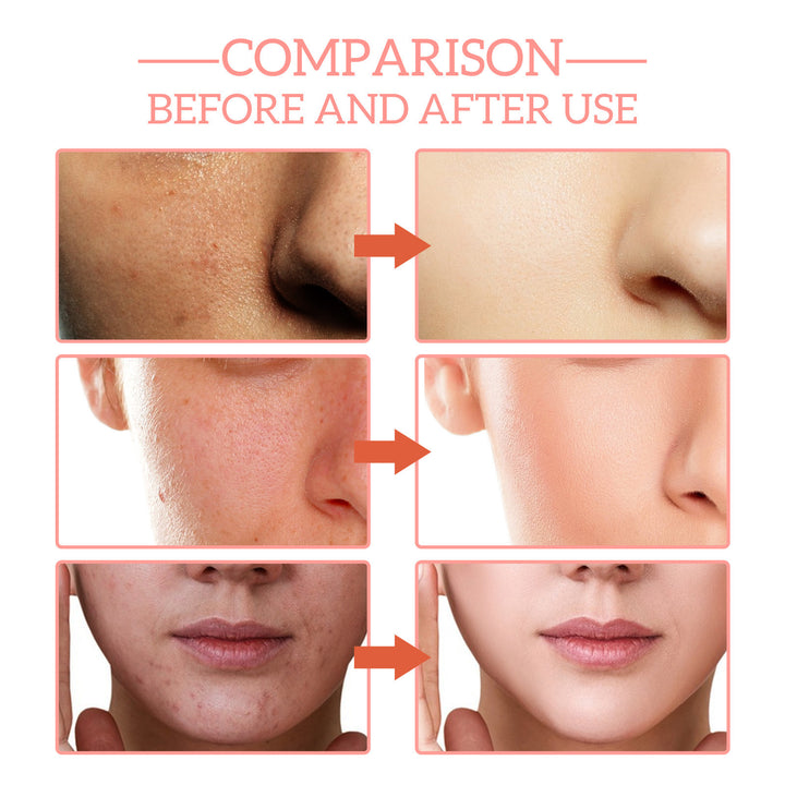 Vitamin C Power Serum 5-in-1