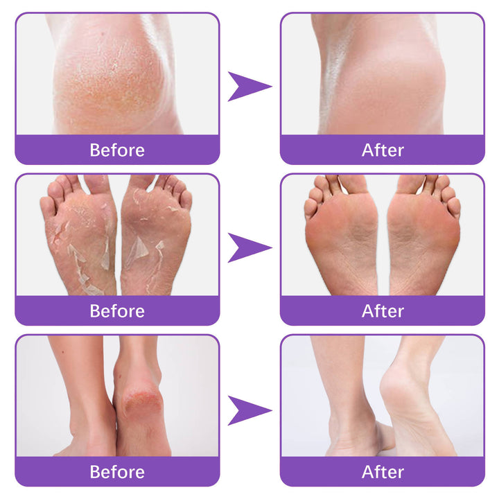 Nourishing Exfoliating Mask for Feet